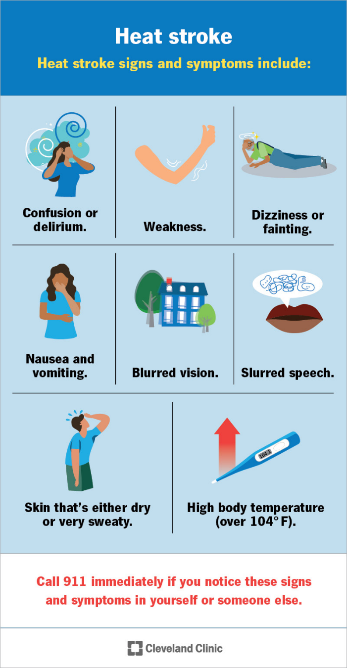 Heat stroke infographic